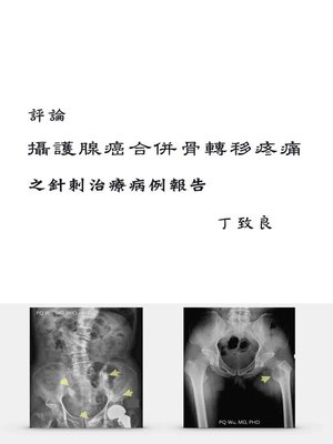 cover image of 評論：攝護腺癌合併骨轉移疼痛之針刺治療病例報告